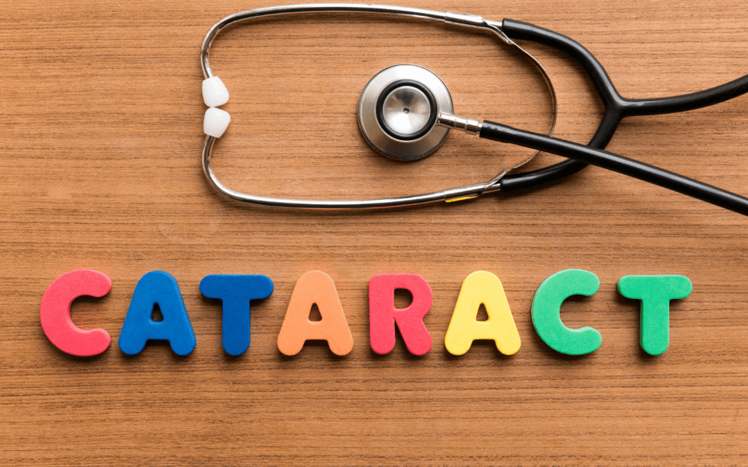 A Clear Guide to Cataracts